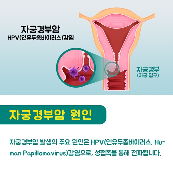 20180423180843%2Ejpg