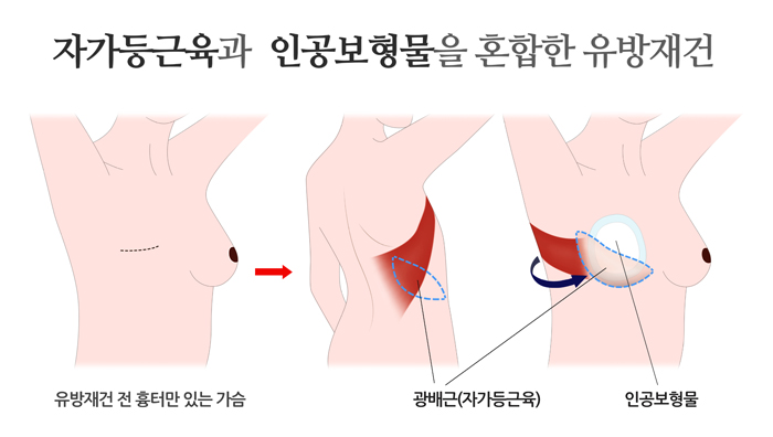 Z1503386480.jpg