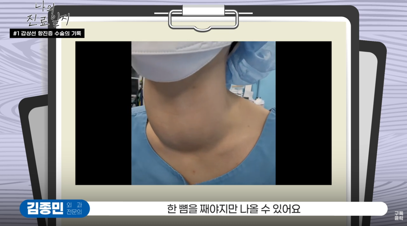 [진료일지] 환자들의 갑상선 내시경수술 만족도가 높은 이유..
