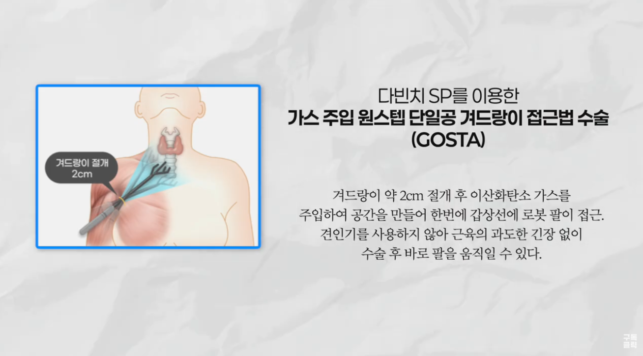 [증례] 겨드랑이 2cm 절개로 마무리한 갑상선 수술 — 다빈치 SP 로봇수술..