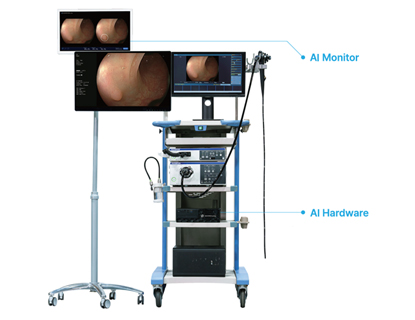 WAYMED ENDO (AI 내시경)