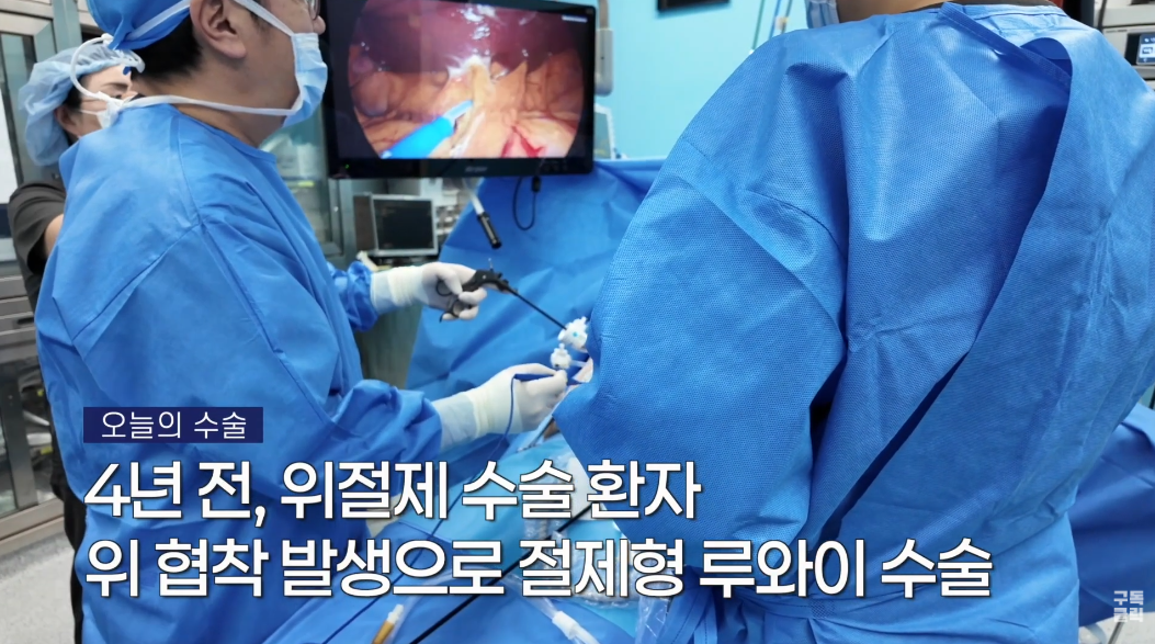 [증례] 위소매절제술 4년 후 위 협착, 절제형 루와이 재수술 ..
