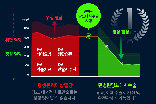 당뇨비만대사수술