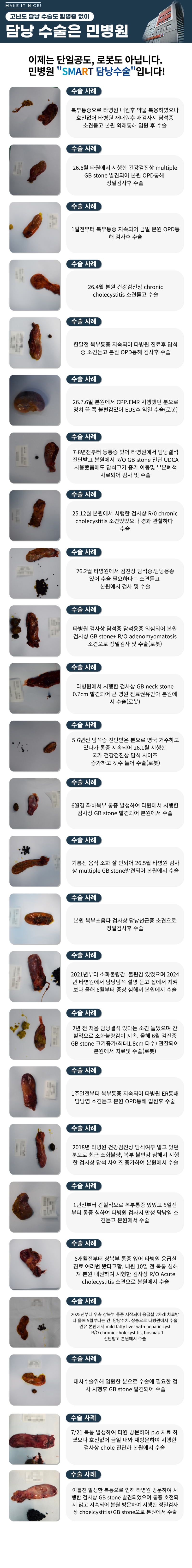 [담낭수술사례] 7월 민병원에서 진행된 담낭수술 사례입니다. ..