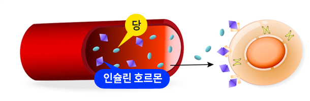 2형 당뇨병