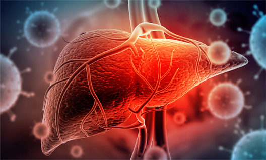 대표적인 간장질환 간병변