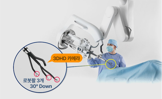 최신 로봇 수술 시스템 도입